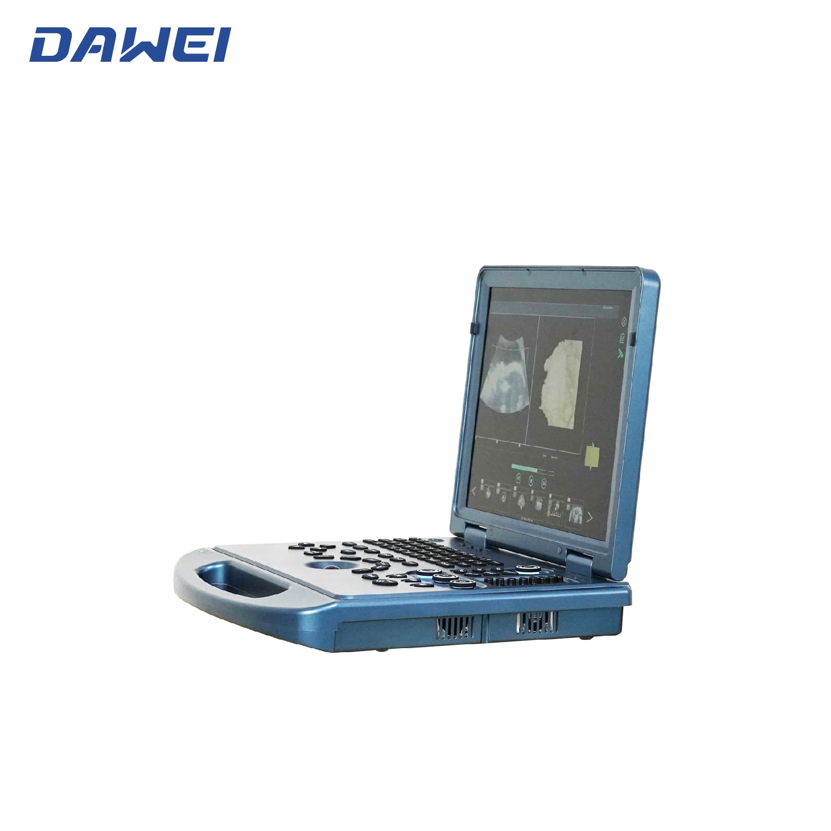 Système d'échographie de couleur portable 4D abordable Système d'échographie de couleur portable 4D abordable