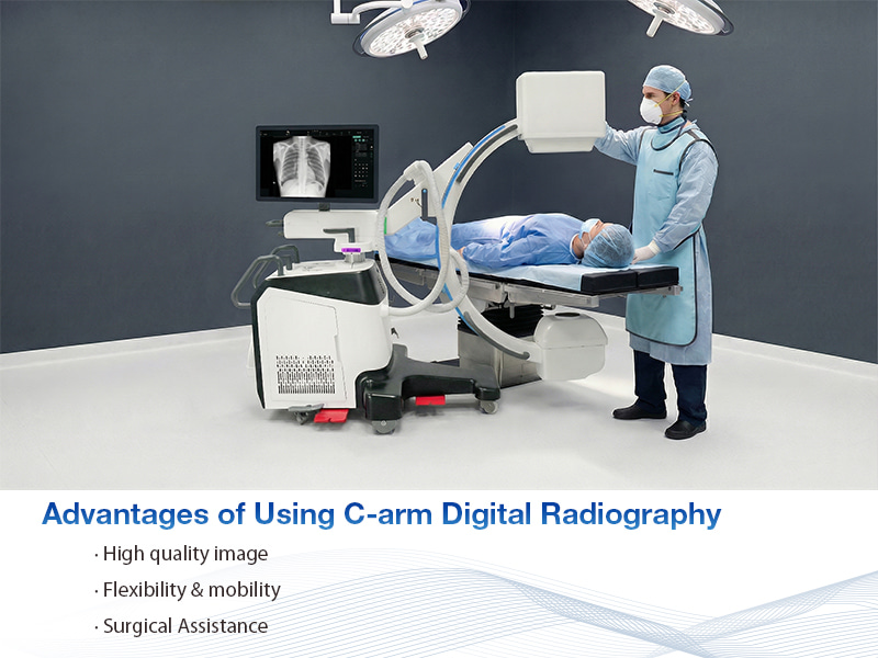 advantages of using C-arm digital radiography avantages de l'utilisation de la radiographie numérique avec arceau