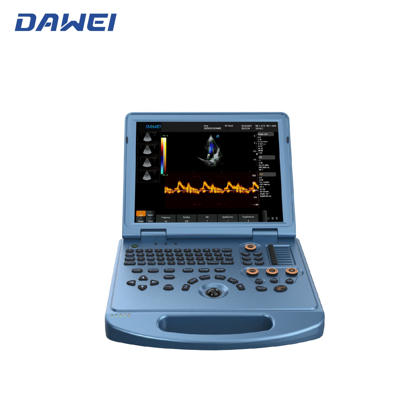 Système d'échographie de couleur portable 4D abordable Système d'échographie de couleur portable 4D abordable
