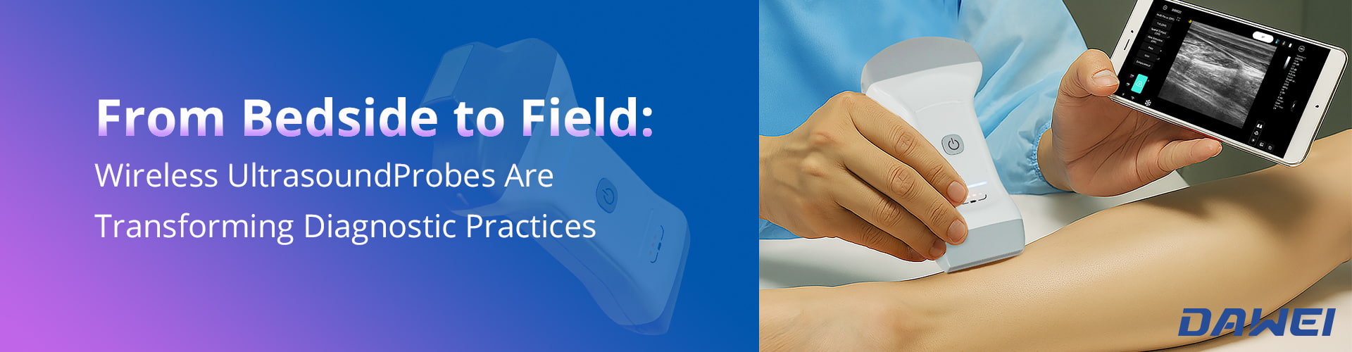 From Bedside To Field How Wireless Ultrasound Probes Are Transforming Diagnostic Practices Du chevet au terrain Comment les sondes à ultrasons transforment les pratiques de diagnostic