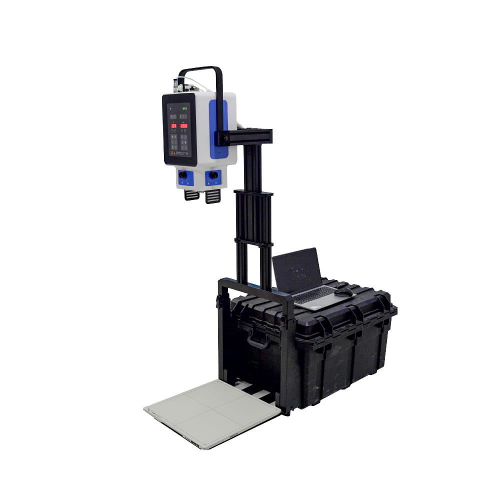 Radiographie numérique mobile Machine à rayons X