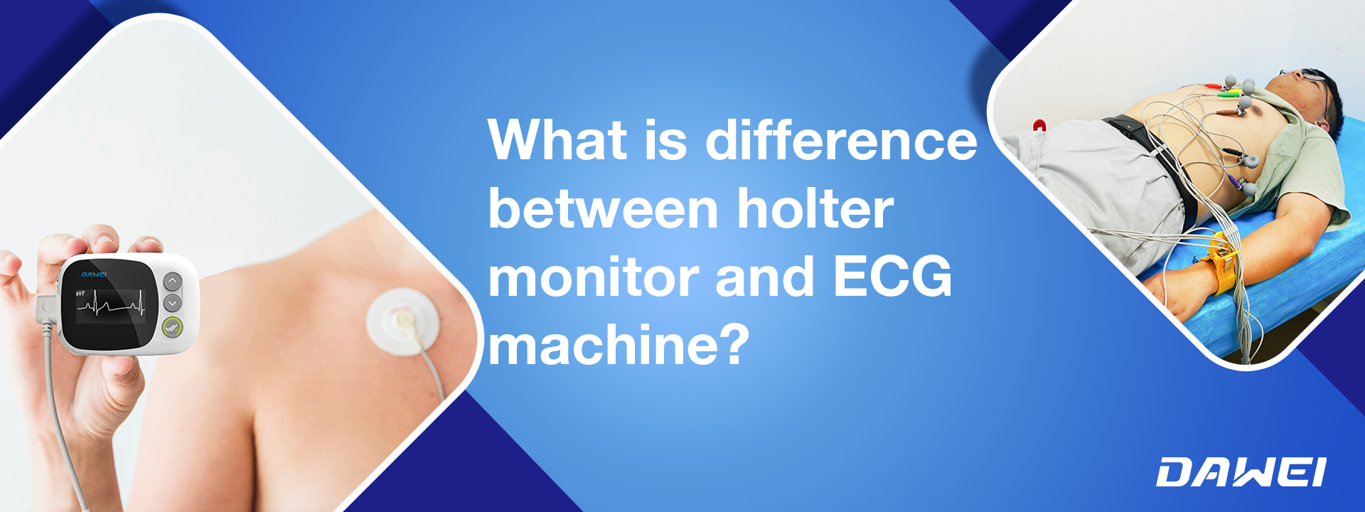 Quelle est la différence entre le moniteur Holter et l'appareil ECG