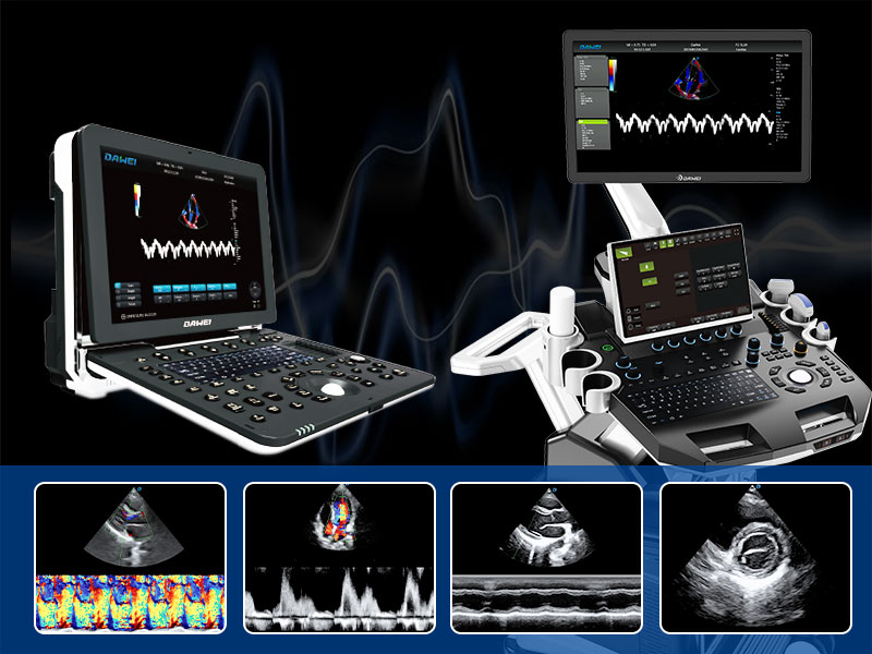 Choosing the Right Cardiology Ultrasound Machine Key Features, Benefits, and Considerations-800-600.jpg