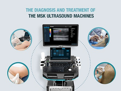 MSK Ultrasound Machines.jpg