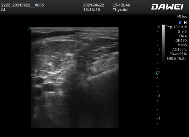 Appareils à ultrasons musculo-squelettiques (MSK) Images