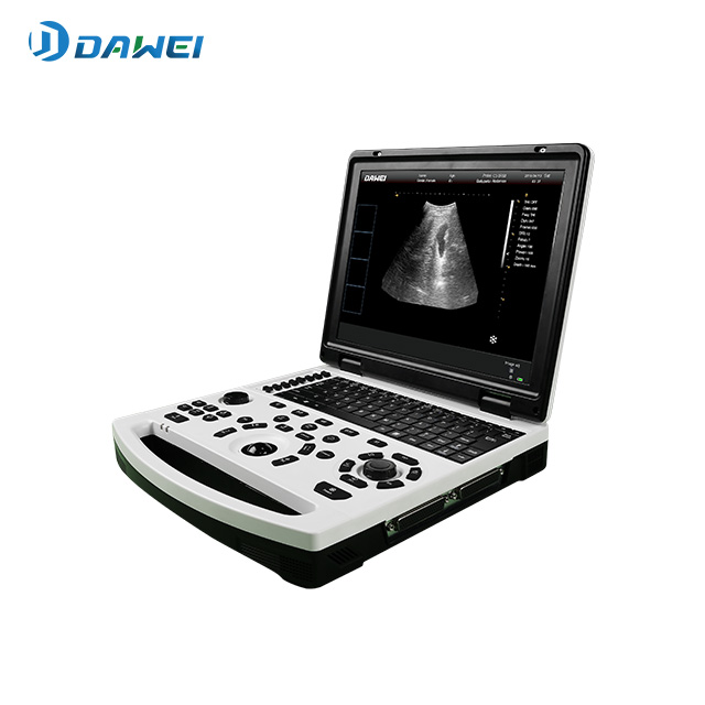 Système de diagnostic ultrasonique portable N/B