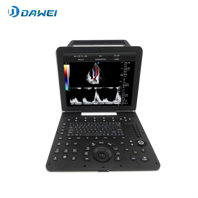 Système de diagnostic ultrasonique couleur cardiaque portable