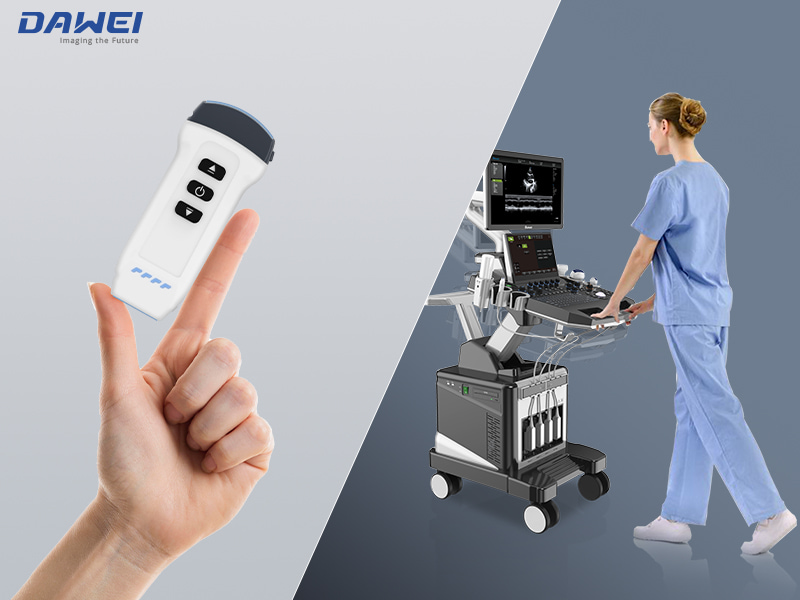 Pocket vs Cart-Based Choisir un &eacute;chographe portable pour l