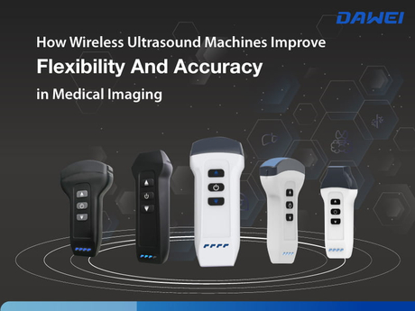 How Wireless Ultrasound Machines Improve Flexibility And Accuracy in Medical Imaging-800-600.jpg