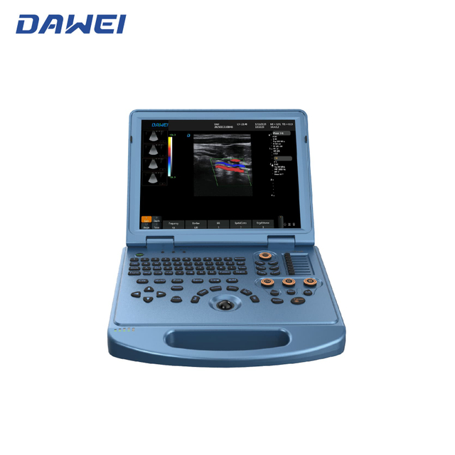 Système d'échographie de couleur portable 4D abordable