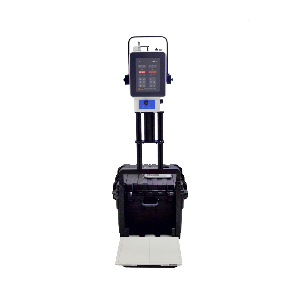 Radiographie numérique mobile Machine à rayons X