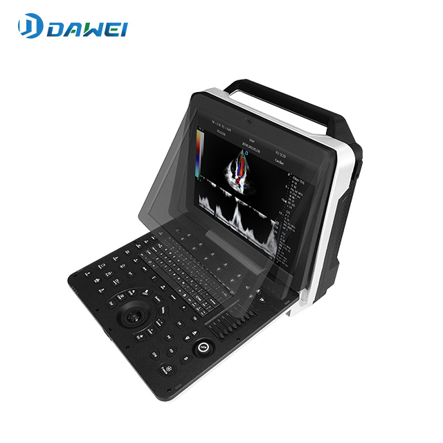 Système de diagnostic ultrasonique couleur cardiaque portable