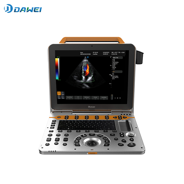 Machine portative d'ultrason de Doppler de couleur du modèle 3D 4D