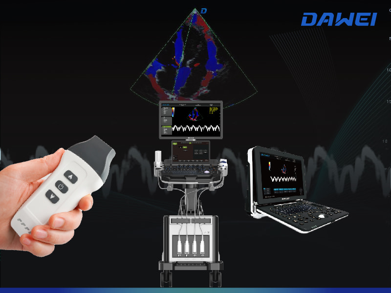 Perc&eacute;e dans l’imagerie du mouvement et du flux sanguin