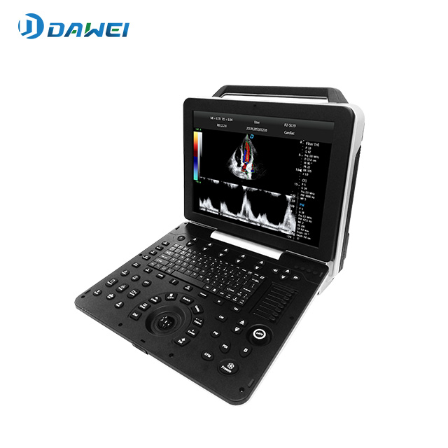 Système de diagnostic ultrasonique couleur cardiaque portable