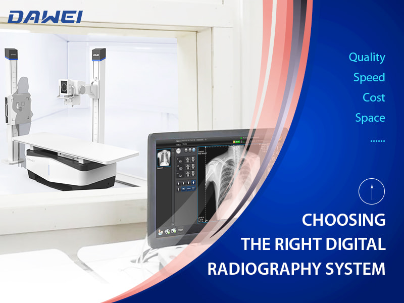 Choisissez le bon appareil de radiographie num&eacute;rique