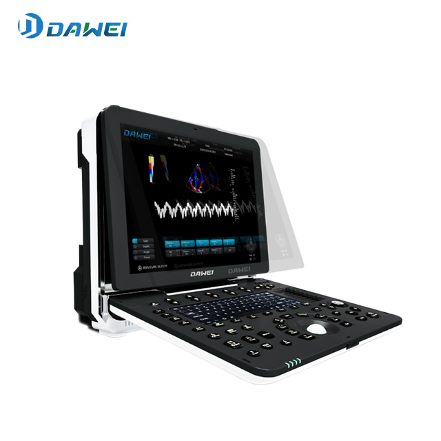 Système de diagnostic ultrasonique couleur cardiaque portable