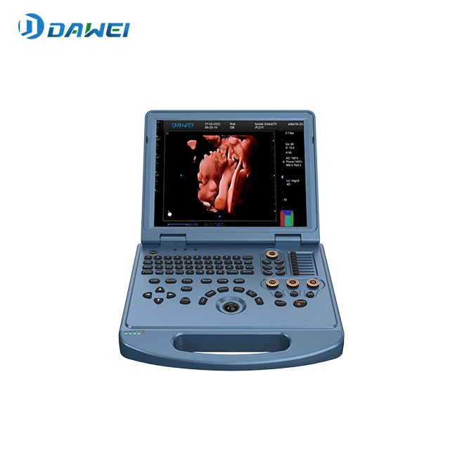 Machine portative d'ultrason de couleur d'OB&GYN