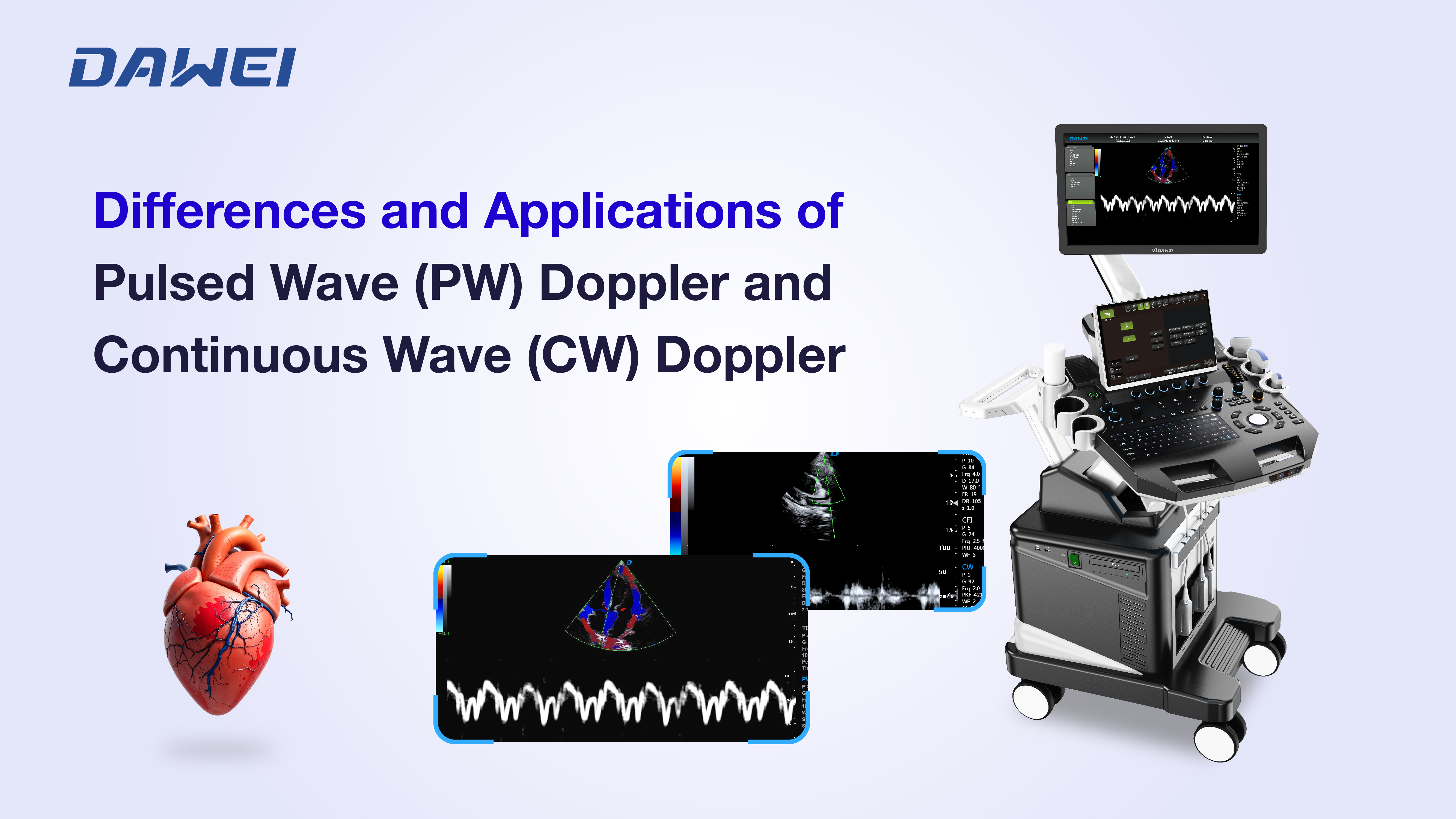 Doppler à ondes pulsées (PW) et Doppler à ondes continues (CW)