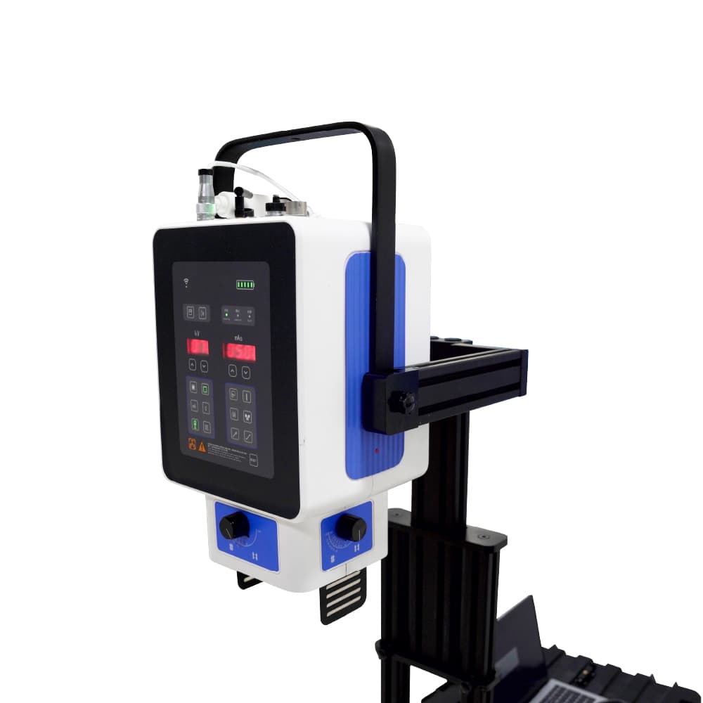 Radiographie numérique mobile Machine à rayons X