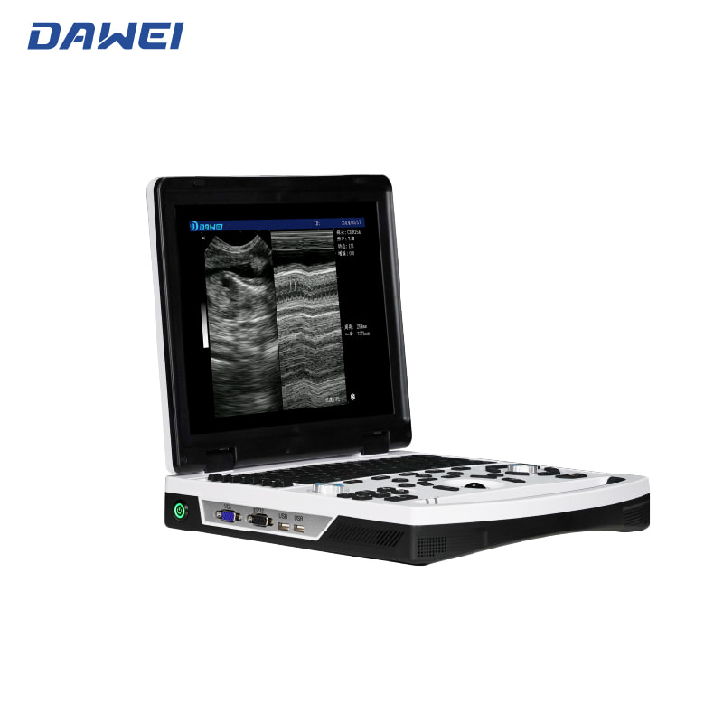 Système de diagnostic ultrasonique B / W portable