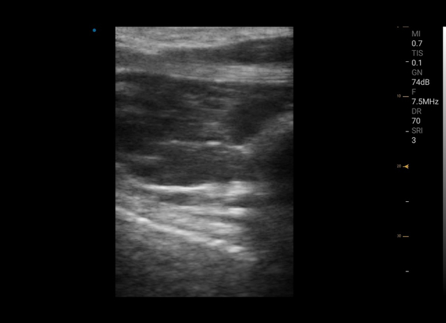 Photos des appareils à ultrasons musculo-squelettiques (MSK)