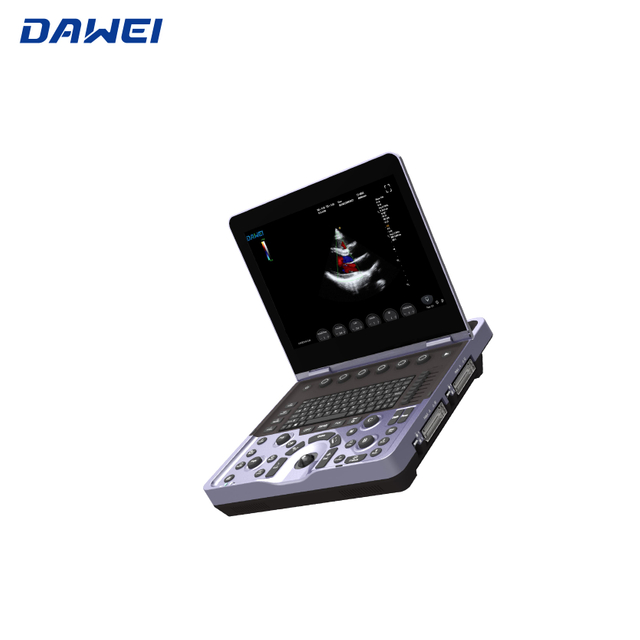 Système d'échographie Doppler couleur pour ordinateur portable