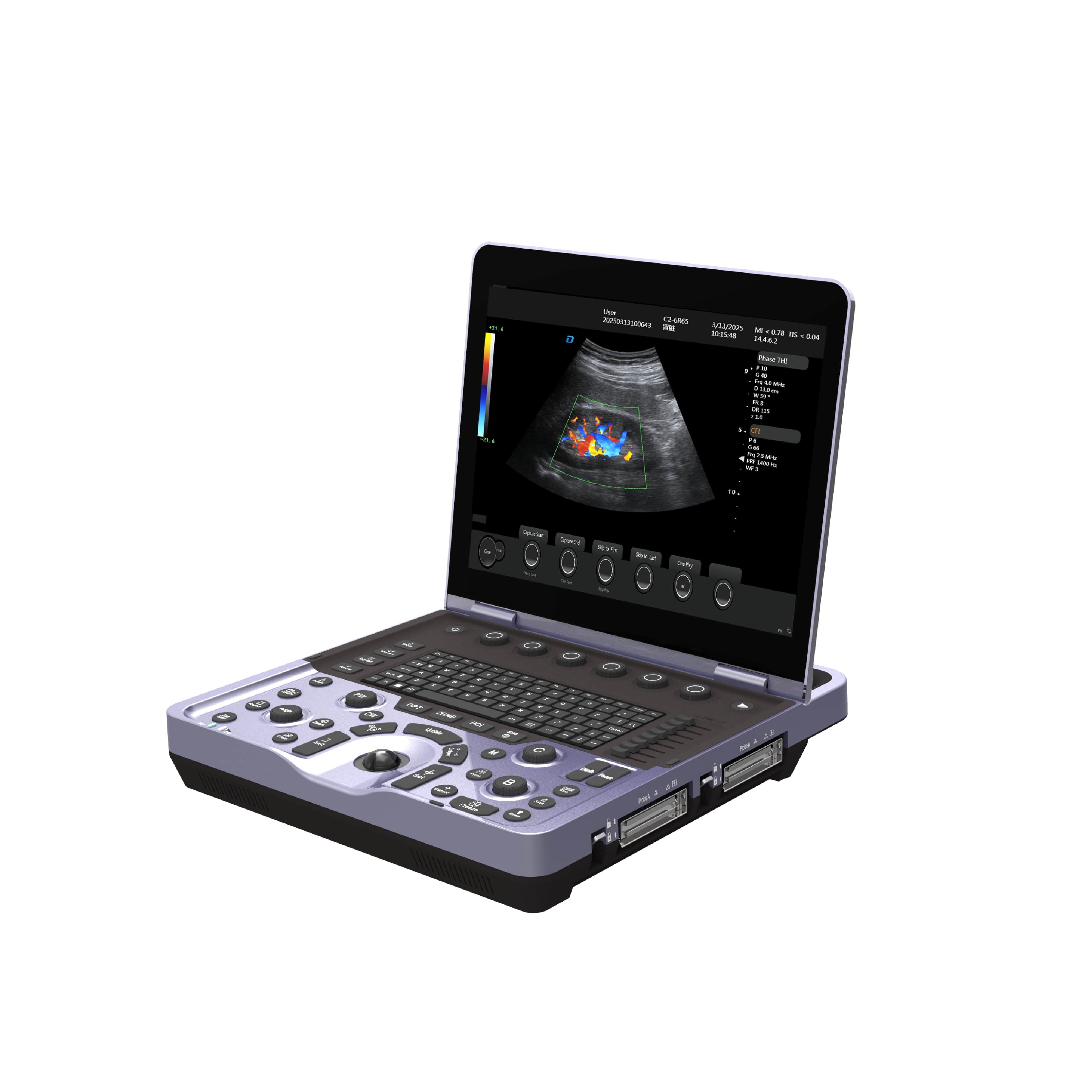 Système d'échographie Doppler couleur pour ordinateur portable