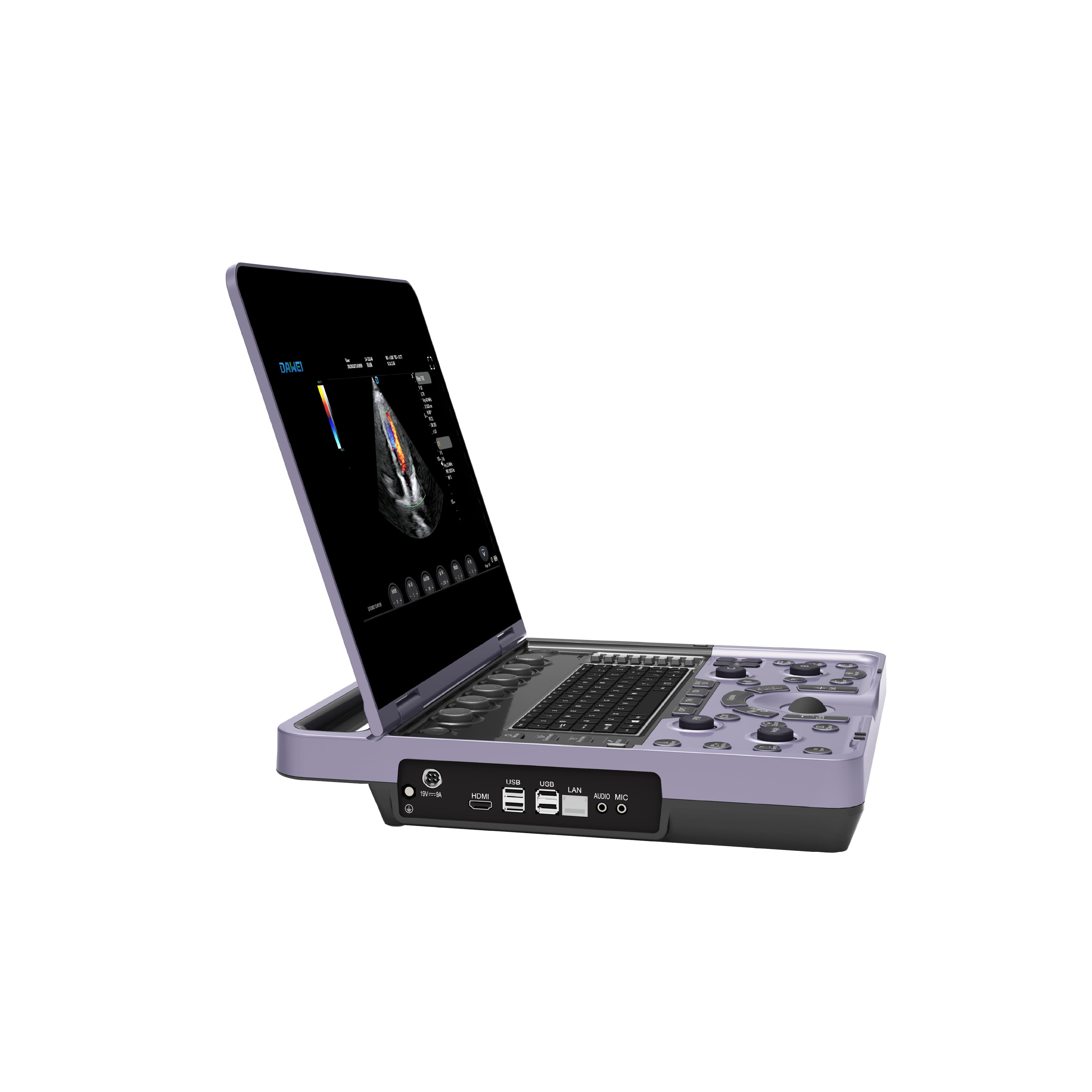 Système d'échographie Doppler couleur pour ordinateur portable