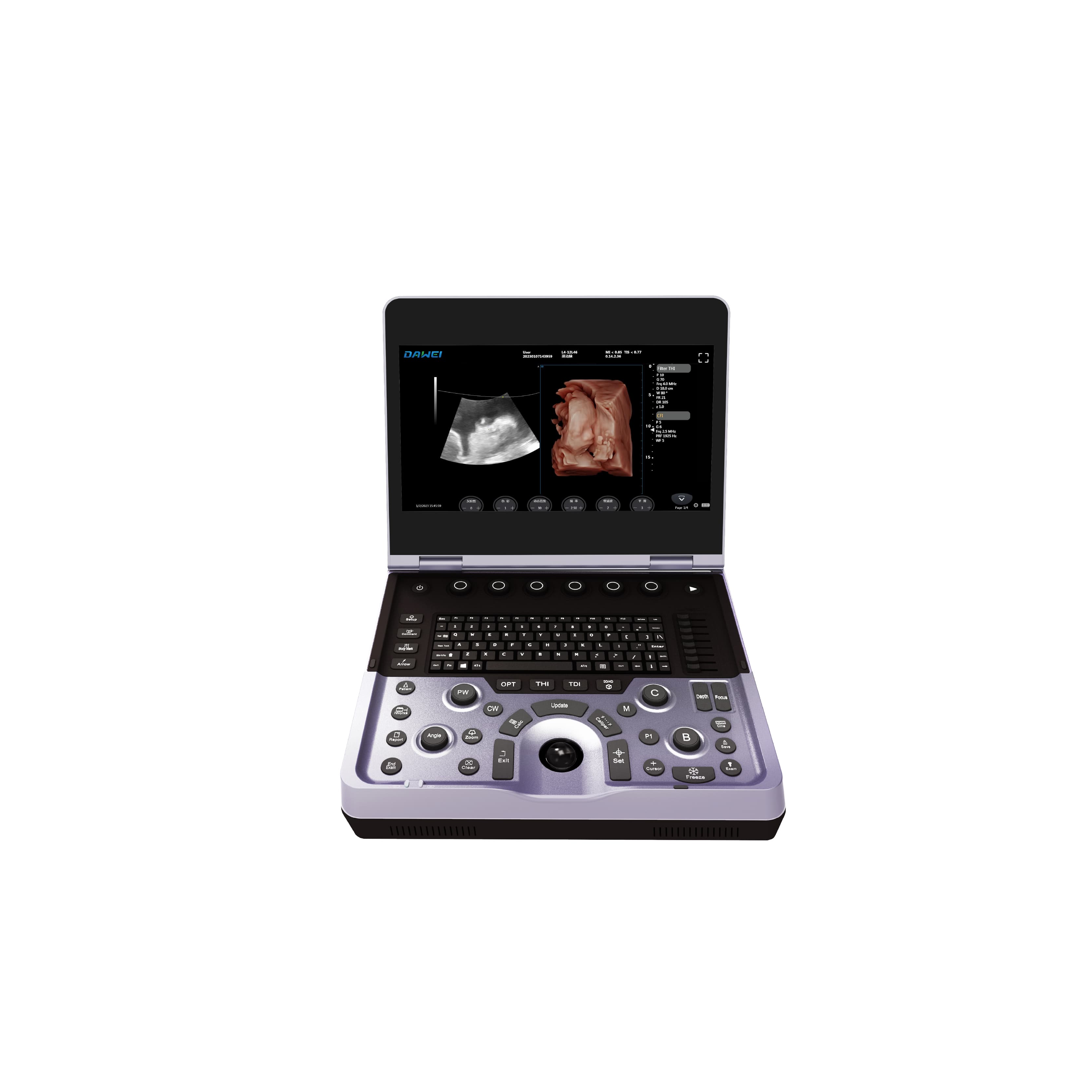 Système d'échographie Doppler couleur pour ordinateur portable
